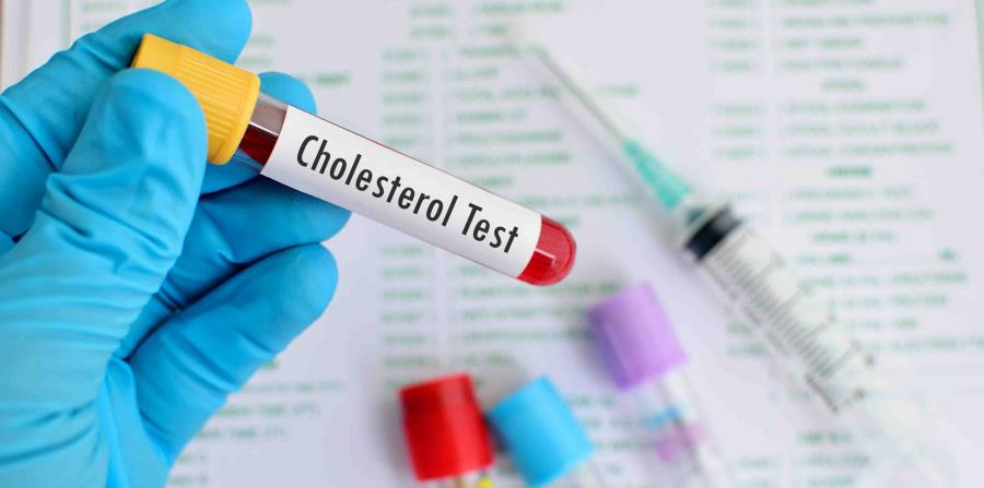 Determinación de colesterol, LDL, HDL, triglicéridos y glucosa