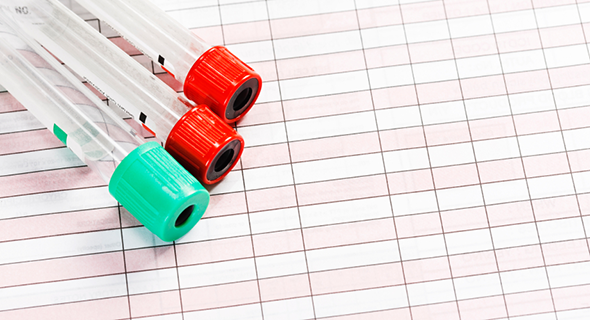Pruebas sanguíneas: Glucosa, Colesterol y Triglicéridos con Accutrend Plus de laboratorios Roche Pruebas sanguíneas: Glucosa, Colesterol y Triglicéridos con Accutrend Plus de laboratorios Roche