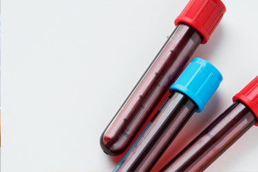 INR control anticoagulación INR control anticoagulación