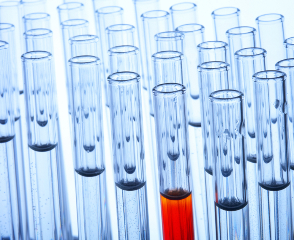 Analítica rápida de sangre con Reflotron Analítica rápida de sangre con Reflotron